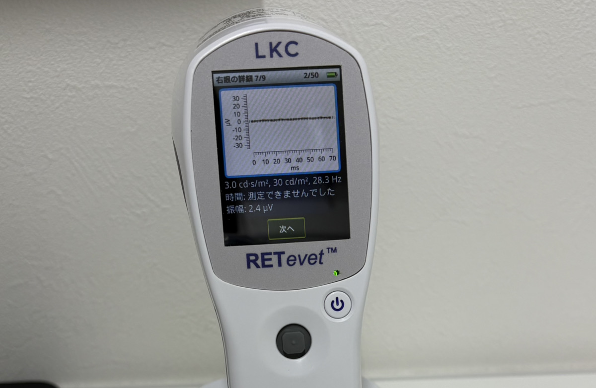 白内障手術の開始と最新検査機器（ERG）導入のお知らせ