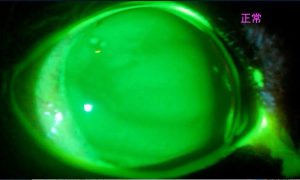 フルオレセイン染色正常